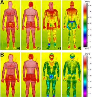 Quelle différence entre cryothérapie corps entier et corps partiel ?