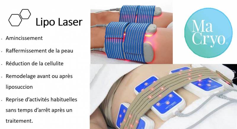 Qu'est-ce que le Lipo Laser à toulon
